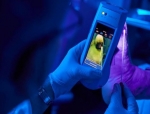 MolecuLight Wins VA Contract for Advanced Wound Imaging Devices