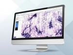 Scopio Labs Receives FDA Clearance for Full-Field Bone Marrow Aspirate Application