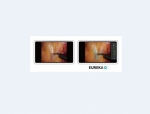Anaut Announces Japanese Regulatory Approval of AI-Powered Surgical Visualization Tool, Eureka