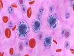Syndax Gets FDA Approval of Revuforj for Relapsed or Refractory Acute Leukemia