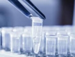 Biomerica inks pact with Canadian partner to distribute & market Helicobacter pylori test, hp+detect