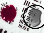Ocutrx Debuts HemoLucence Surgical Breakthrough