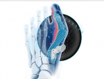 Johnson and Johnson Unveils AI Solution for Bunion Surgery, Seeks FDA Nod to Expand TREMFYA Label