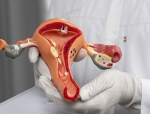 GSK Enters Oncology in India with Launch of Jemperli and Zejula for Gynaecological Cancers