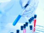 First patient outside U.S. treated in global Kevzara clinical trial program for patients with severe COVID-19