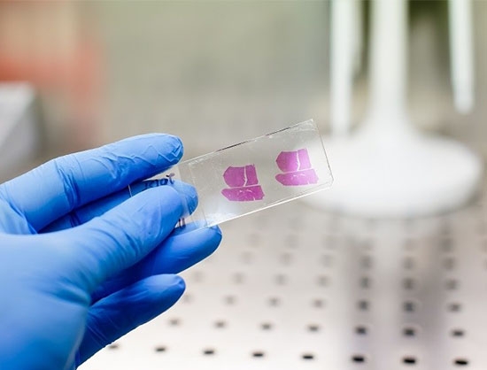 Zenbio BioIVT Acquires ZenBio to Expand its Pharmaceutical Portfolio - Drug ...