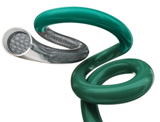 Terumo Neuro Launches SOFIA 88, Expanding Stroke Portfolio with Large-Bore Catheter