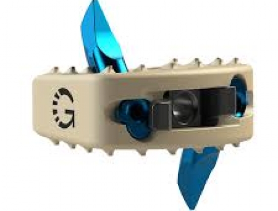 Genesys Spine Launches Stasys-C 3DP, a Zero-Profile 3D-Printed Cervical Standalone System