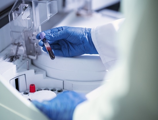 ICMR and CDSCO Release First Set of 39 Standard IVD Evaluation Protocols