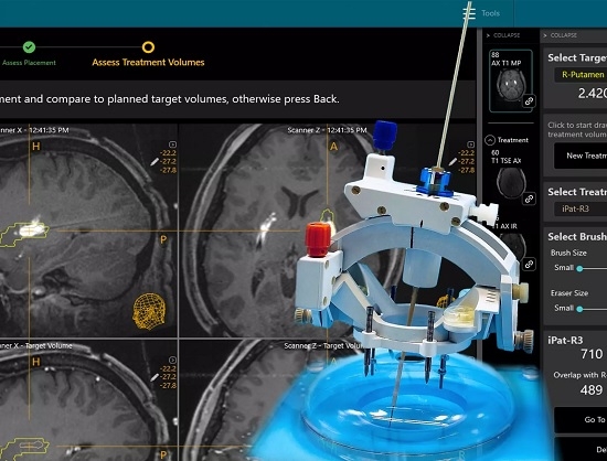ClearPoint Neuro Develops Robotic Neuro-Navigation System to Enhance Cranial Surgery Procedures