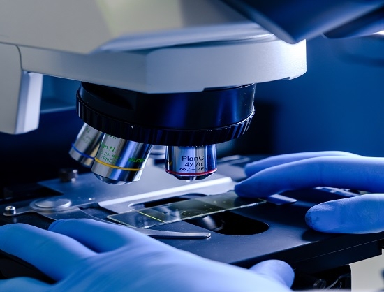 Thermo Fisher launches Molecular Microscope to assess lung transplant rejection