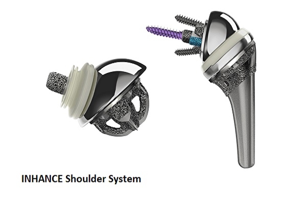 Johnson & Johnson MedTech Launches INHANCE INTACT System for Muscle-Sparing Shoulder Replacement