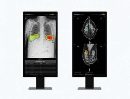 Lunit Expands Presence in Europe: to Deliver AI-powered Cancer Screening Solution to France and Portugal