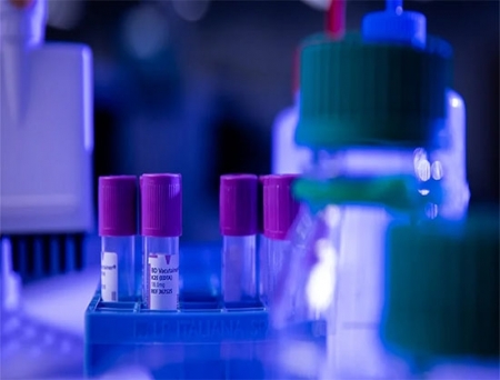 Microbiologics Acquires SensID to Expand its Portfolio in Diagnostic Quality Controls