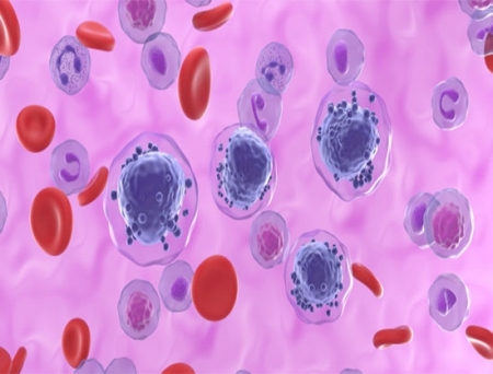 Syndax Gets FDA Approval of Revuforj for Relapsed or Refractory Acute Leukemia