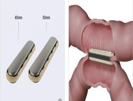 GT Metabolic Gets FDA Approval for 50mm MagDI System to Expand Surgery Options