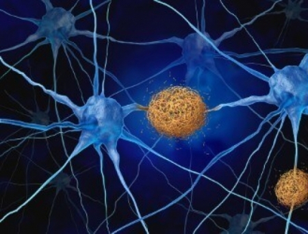 ARUP Laboratories Introduces pTau 217 Blood Test to Support Alzheimer's Disease Diagnosis in Older Adults