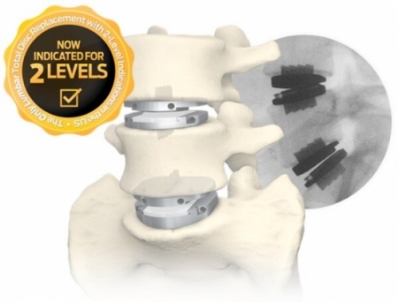 Centinel Spine Releases New Instrumentation for its Prodisc L Lumbar Total Disc Replacement System