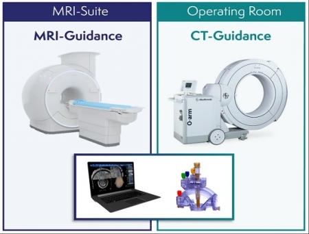 Clearpoint Prism Neuro Laser Therapy System Receives FDA Clearance for 1.5T MRI Use