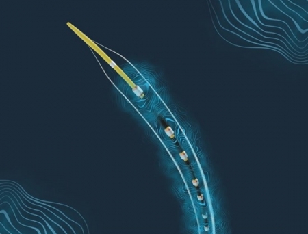 Johnson & Johnson MedTech Confirms Durability of IVL in Complex Below-the-Knee Lesions in PAD Patients