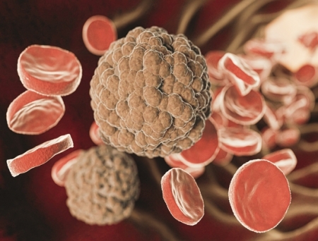 Innovent's Tri-Specific Antibody IBI3003 Secures FDA Fast Track Status for Relapsed/Refractory Multiple Myeloma