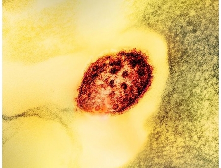 Researchers Discover First Human Antibody Panel Targeting Measles Virus